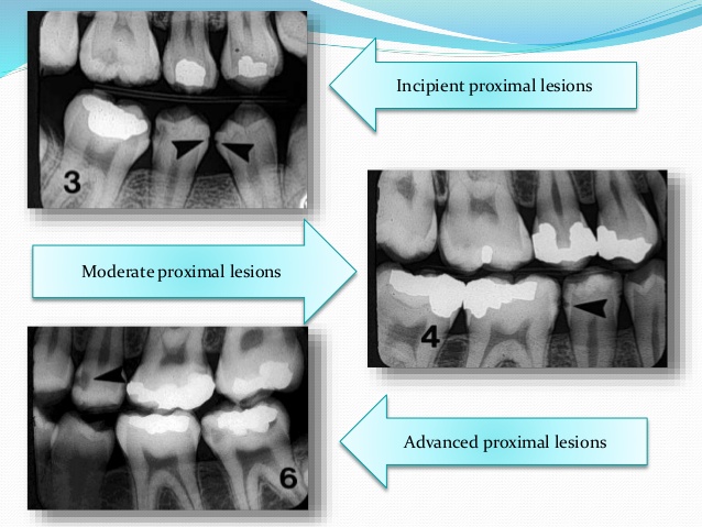 diagnostic xrays for early detection