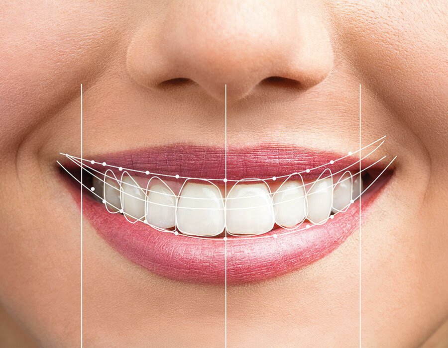 Full dentures