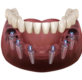 Orthodontics